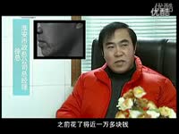 热推 西安哪里<em>可以植头发</em>-碧莲盛_17173游戏视